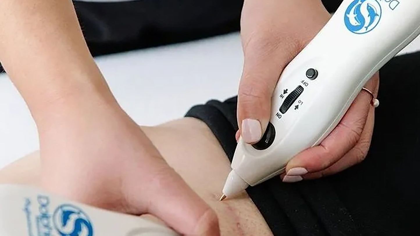 Matthew' hands - fingers intertwined for Micropoint Stimulation